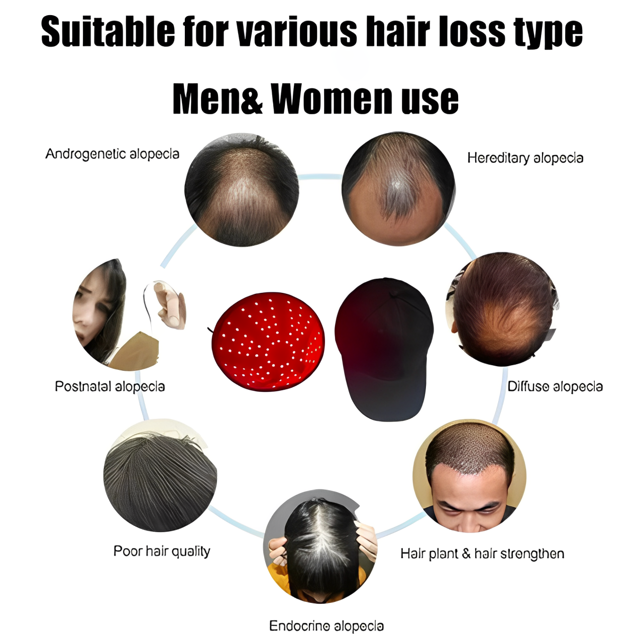 Medical-Grade Laser Cap for Hair Growth