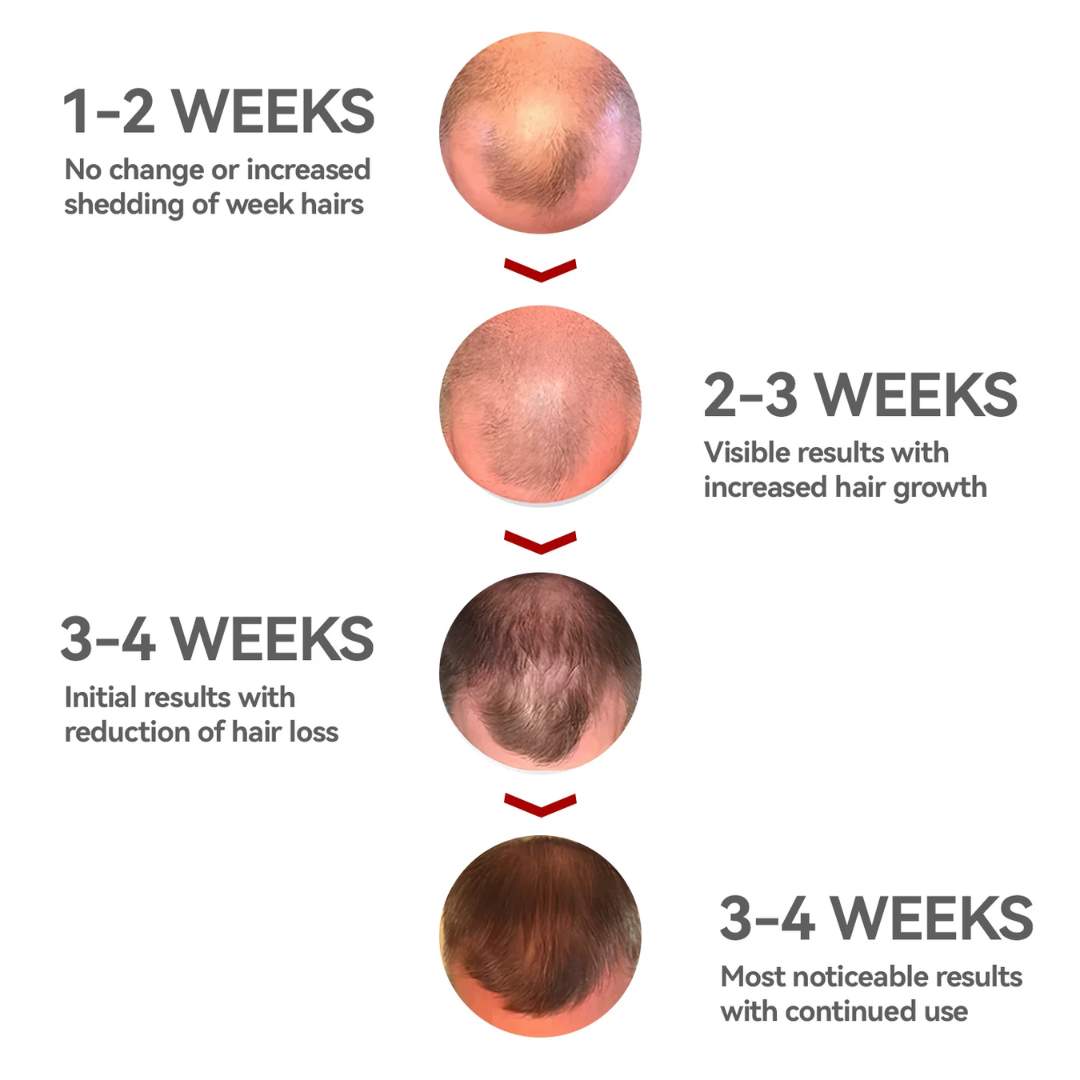 Red Light Therapy Cap – Fast Hair Growth, Brain & Nerve Wellness, Pain-Free