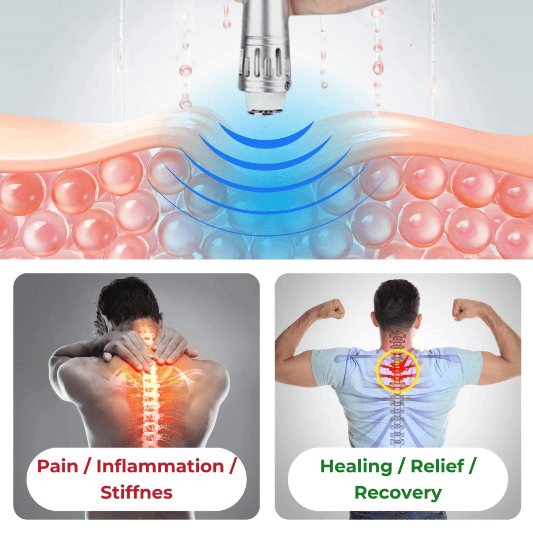 Portable Shockwave Therapy Device – Pain Relief & Tissue Regeneration at Home