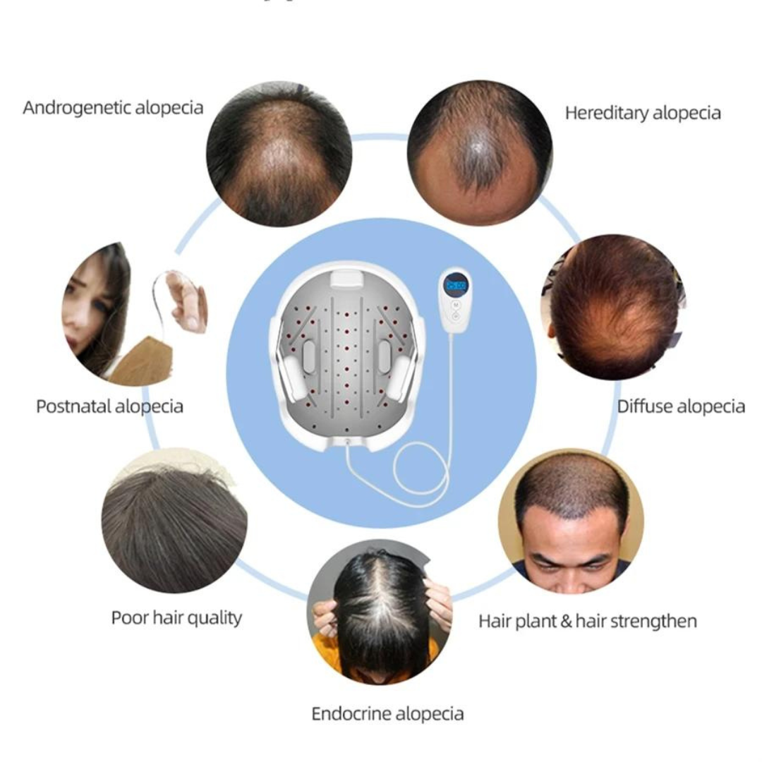 Laser & LEDs Hair Growth Helmet