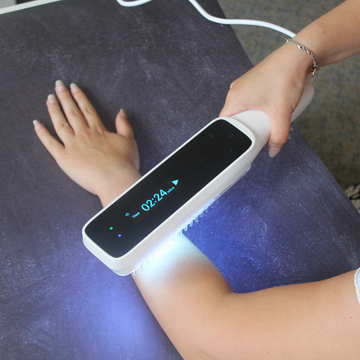 Handheld UVB Narrowband Phototherapy lamp