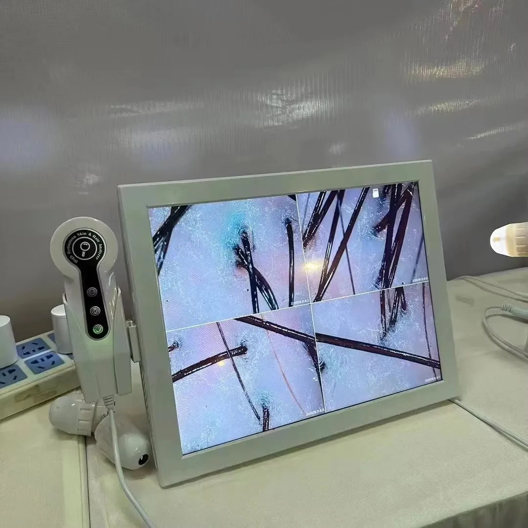 High-Resolution Hair Follicle and Scalp Diagnostic Machine