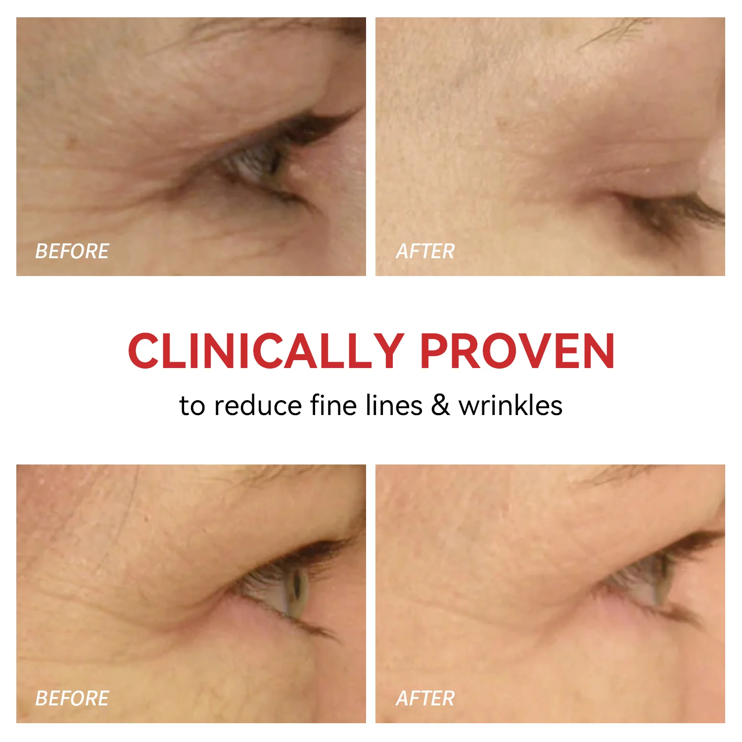 Red Light Therapy for Eyes | Reduce Fine Lines and Wrinkles |Anti Eye Bags