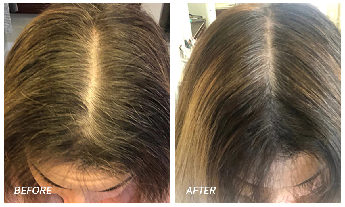 At Home Infrared Red light hair growth Cap with 120 LED